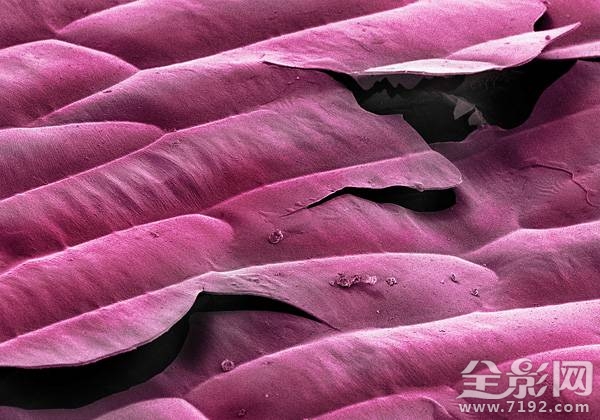 显微摄影术 显微摄影照片图1