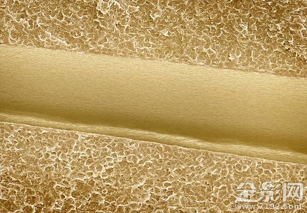 显微摄影术 显微摄影照片