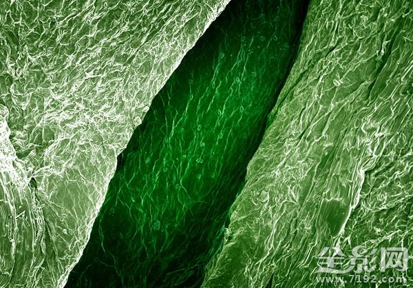 显微摄影术 显微摄影照片