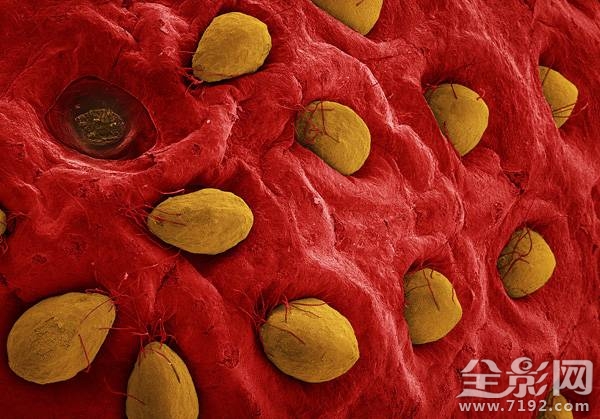 显微摄影术 显微摄影照片