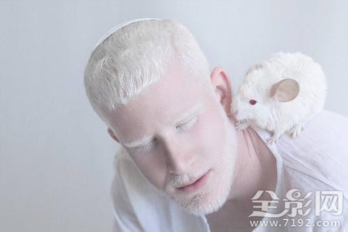 摄影师为白化病人拍唯美大片视频 白化病人拍的照片图3